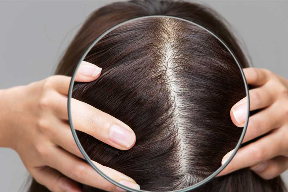 Cách tẩy tế bào chết da đầu cho mái tóc chắc khỏe