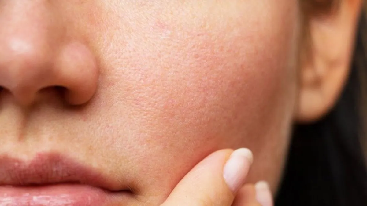 Bảo vệ hàng rào da: Chống lão hóa mùa đông