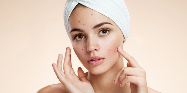 kem trị mụn hiệu quả được ưa chuộng hiện nay