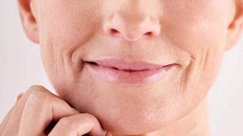 Lão hóa ở khóe miệng: Hướng dẫn chuyên sâu giúp phụ nữ trên 40 tuổi ngăn