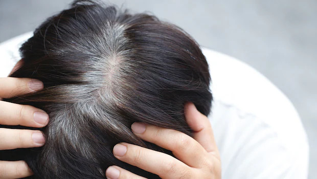 Mẹo cải thiện tóc bạc sớm bằng nguyên liệu thiên nhiên